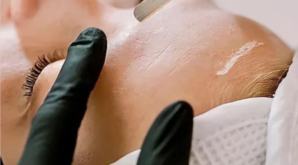 Dermaplaning | Meraki Aesthetics and Company PLLC | Cornelius, NC