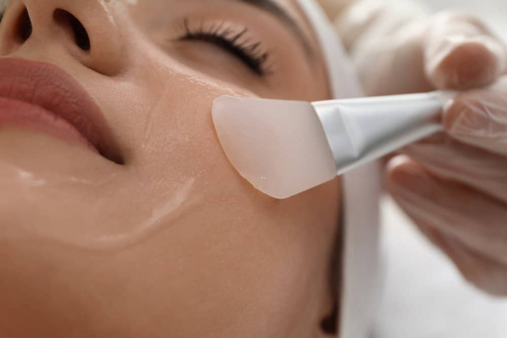 CHEMICAL PEELS | Meraki Aesthetics and Company PLLC | Cornelius, NC