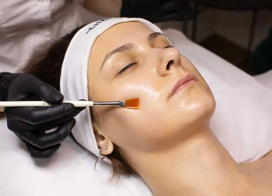 Chemical Peels Treatment by Meraki Aesthetics and Company in Cornelius, NC